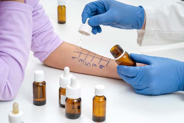 The Benefits Of Allergy Testing